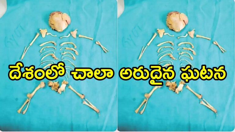 విశాఖ: కడుపునొప్పితో వచ్చిన మహిళకు స్కానింగ్.. రిపోర్ట్ చూసి డాక్టర్లు షాక్, వామ్మో ఎలా సాధ్యం