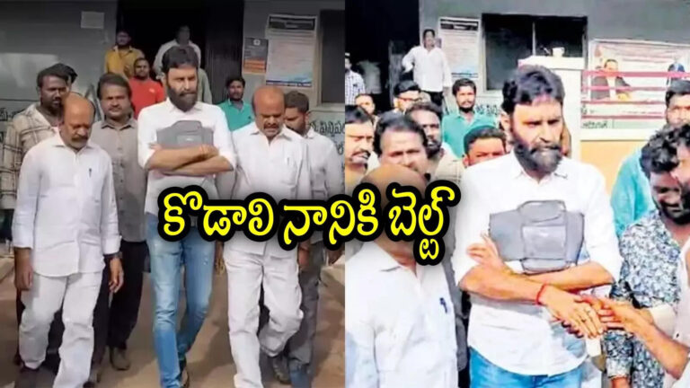 Kodali Nani Surgery Belt,కొడాలి నాని షర్ట్‌కు స్పెషల్ బెల్ట్.. ఇంతకీ ఆ మెషిన్ ఎందుకంటే! – kodali nani wears surgery belt in gudivada